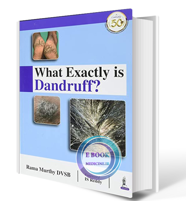 دانلود کتاب What Exactly is Dandruff?  2020 (ORIGINAL PDF)